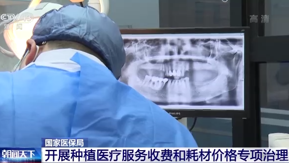 怎么查询医保耗材价格国家医保局：调控单颗常规种植牙医疗服务价格 种植体、牙冠等耗材价格将降低_https://www.jmylbn.com_新闻资讯_第1张