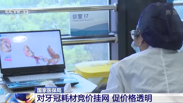 怎么查询医保耗材价格国家医保局：调控单颗常规种植牙医疗服务价格 种植体、牙冠等耗材价格将降低_https://www.jmylbn.com_新闻资讯_第4张